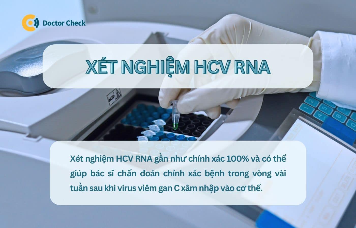 Xét nghiệm HCV RNA