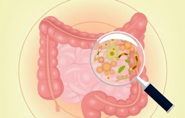 Nhiễm khuẩn đường tiêu hóa là một trong các nguyên nhây gây bệnh Crohn. (Ảnh minh họa sưu tầm)