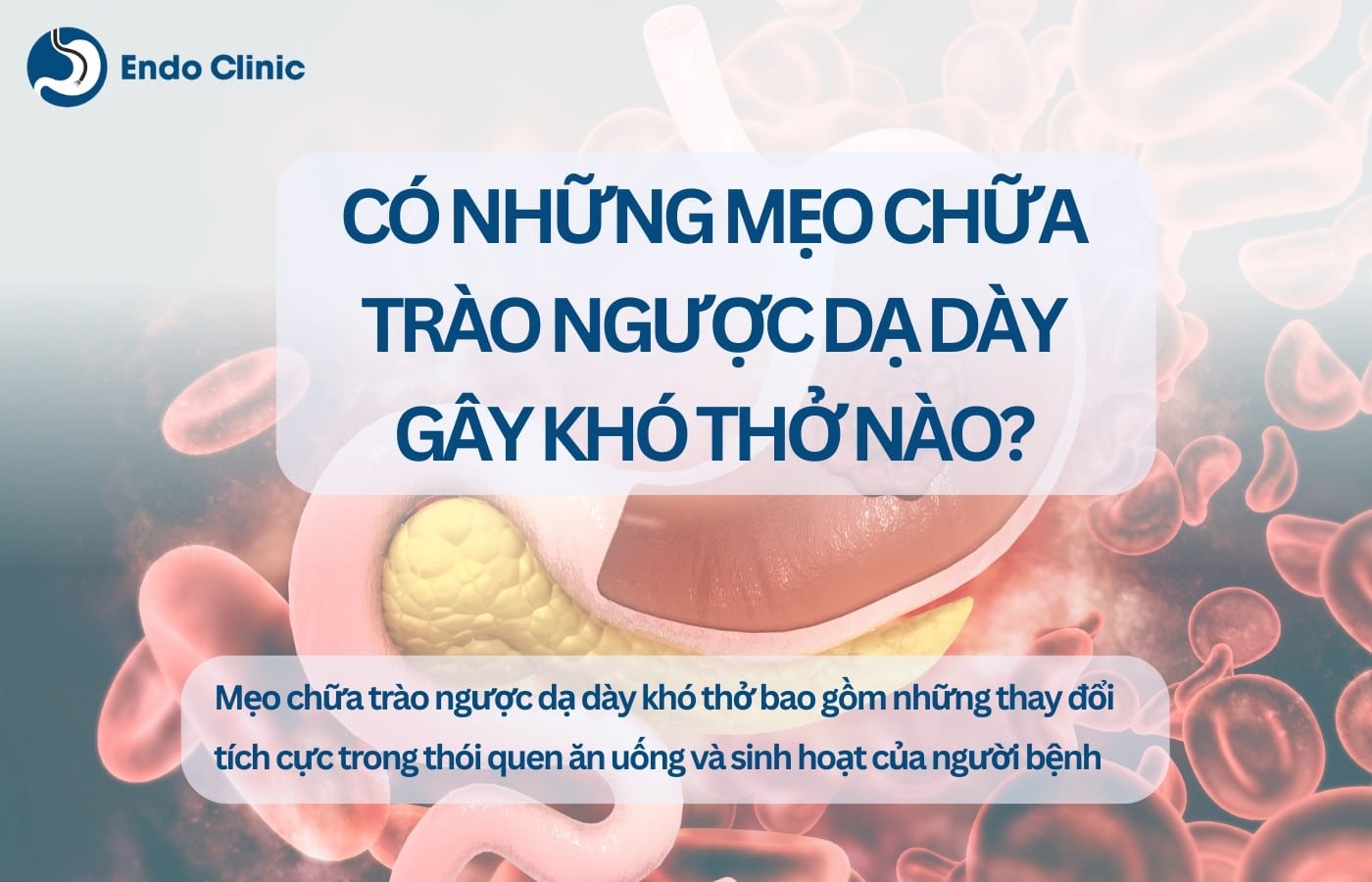 Mẹo chữa bệnh trào ngược dạ dày thực quản gây khó thở bằng cách nào?