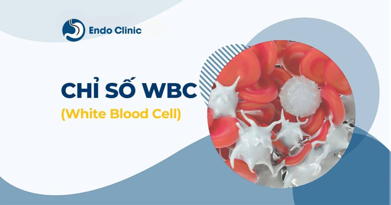 WBC trong xét nghiệm máu là gì? Chỉ số WBC trong máu cao nguy hiểm không?