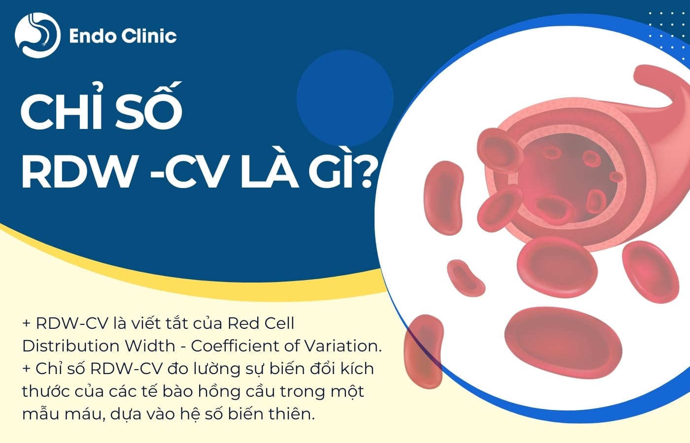 Chỉ số RDW-CV trong xét nghiệm công thức máu là gì