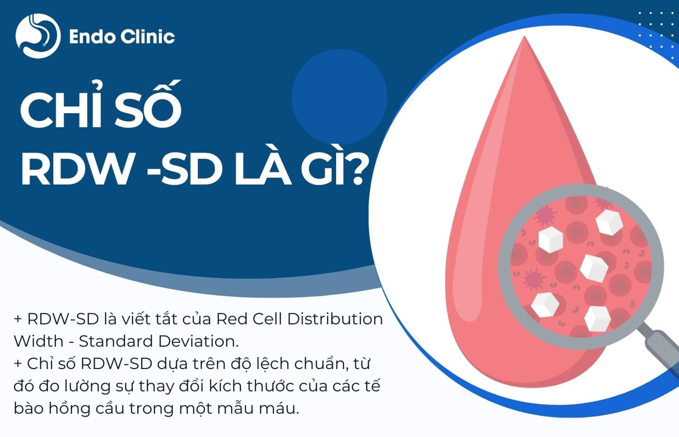 Chỉ số RDW-SD trong xét nghiệm công thức máu là gì