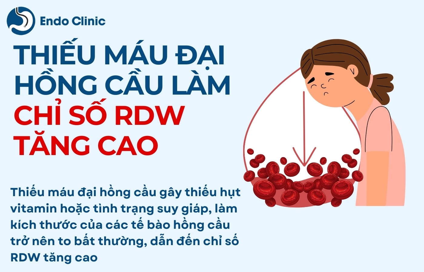 Thiếu máu đại hồng cầu làm chỉ số RDW trong máu tăng cao
