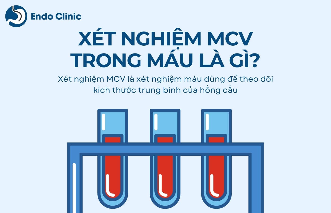 Xét nghiệm chỉ số MCV trong máu là gì