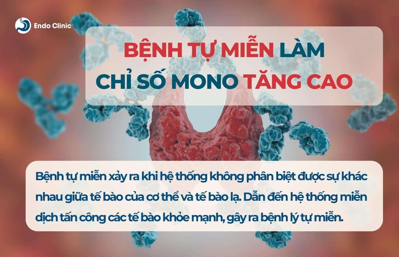 Bệnh tự miễn