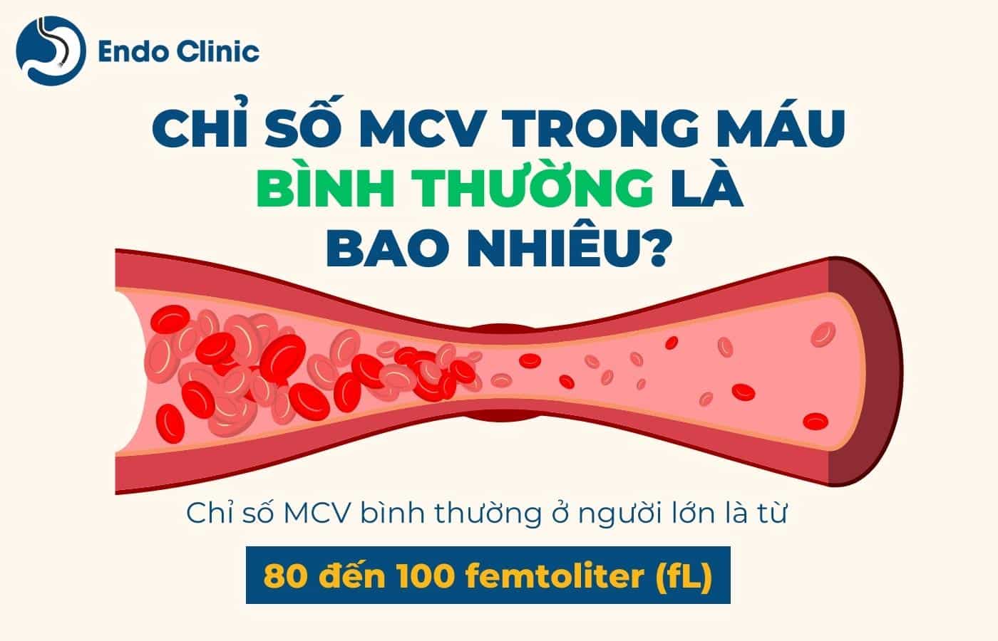 Chỉ số MCV trong xét nghiệm máu bao nhiêu là bình thường?