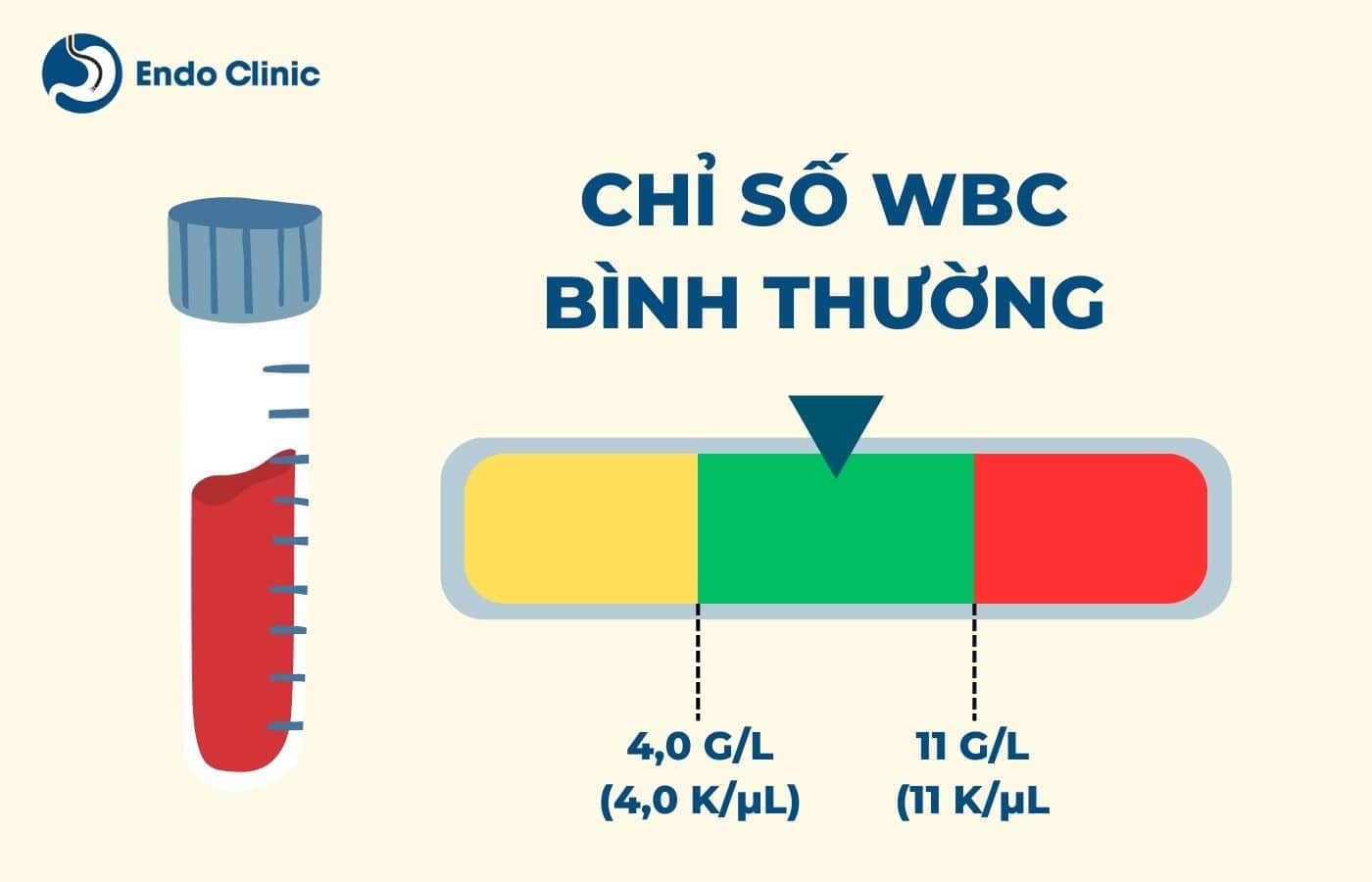 Chỉ số WBC bao nhiêu là bình thường?