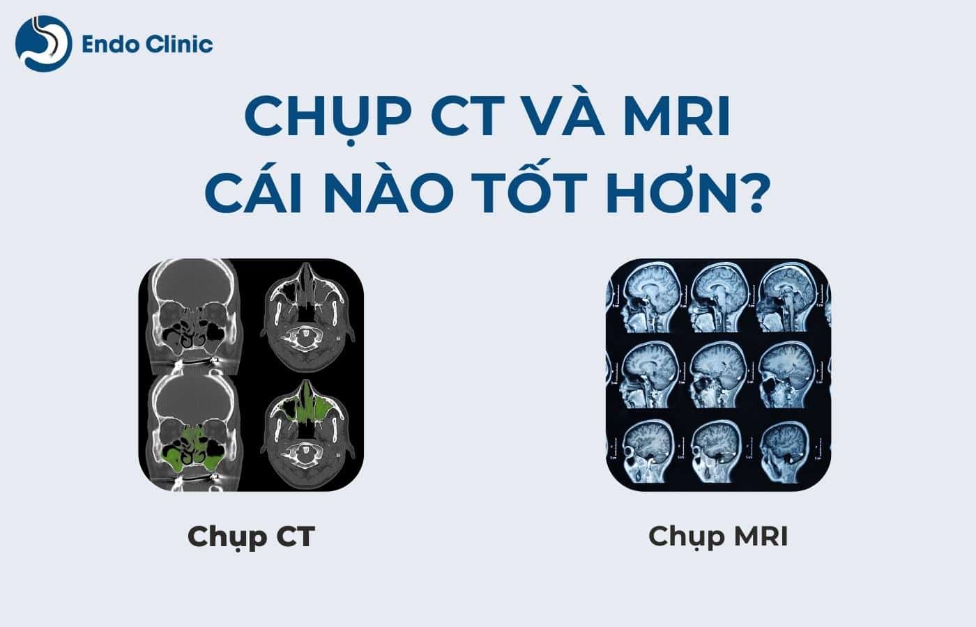 Chụp CT và MRI cái nào tốt hơn?