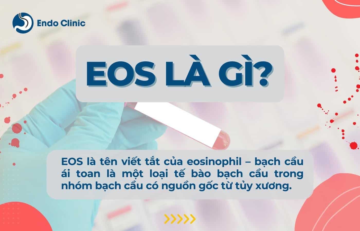 EOS là gì?