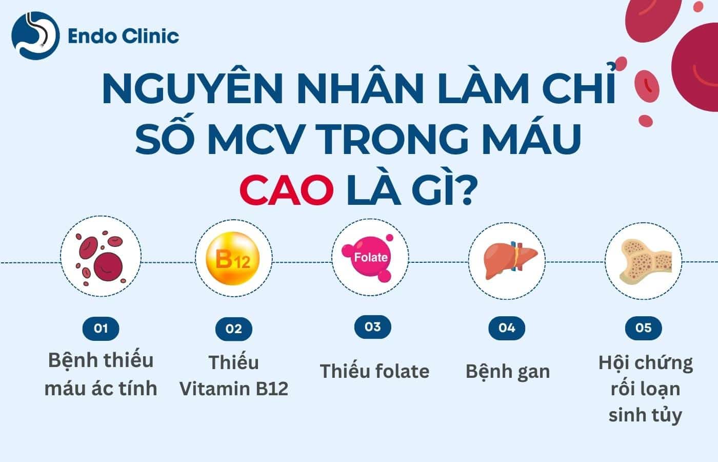 Nguyên nhân làm chỉ số MCV trong xét nghiệm máu cao là gì