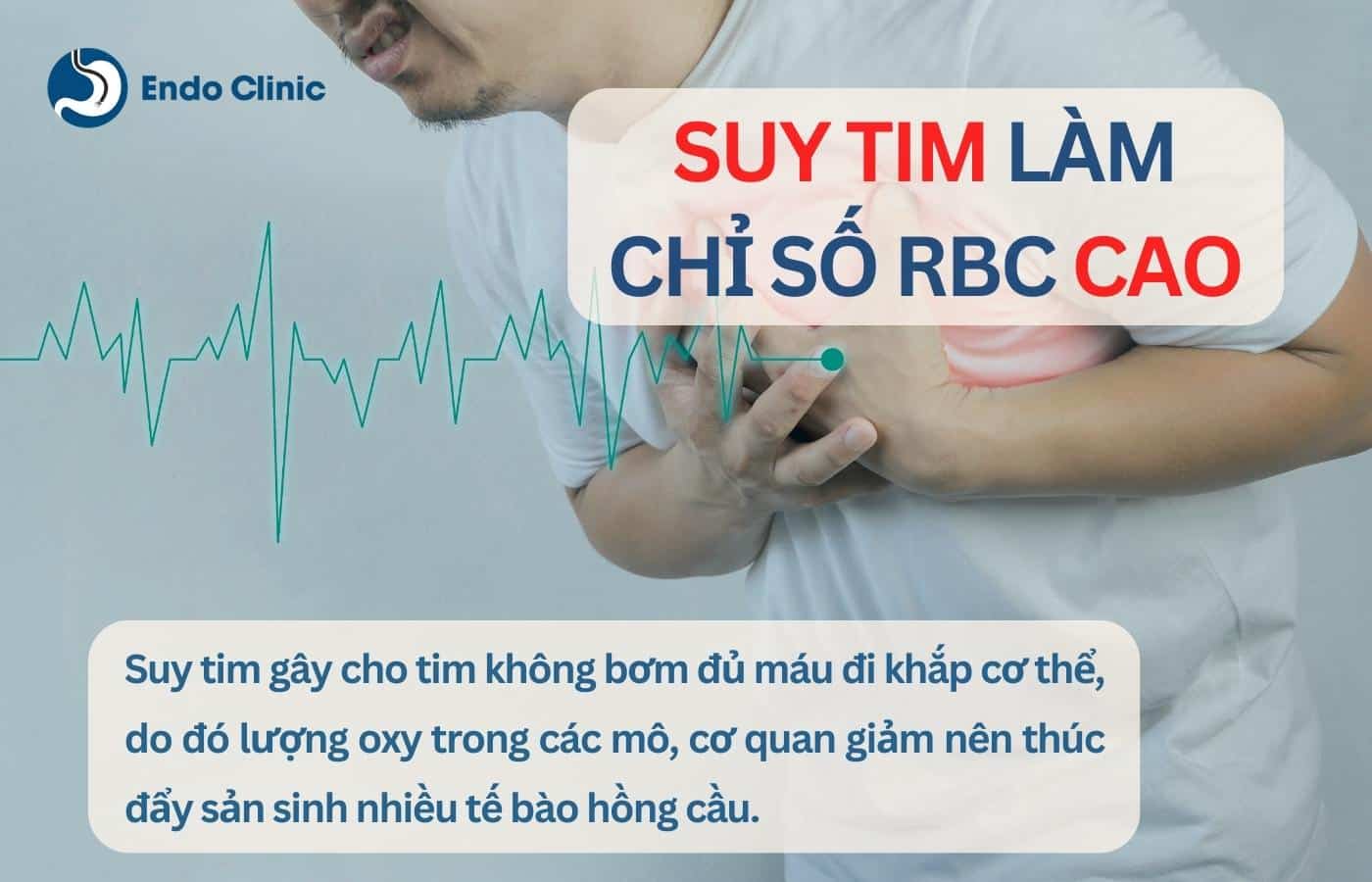 Suy tim làm chỉ số RBC trong xét nghiệm máu tăng cao