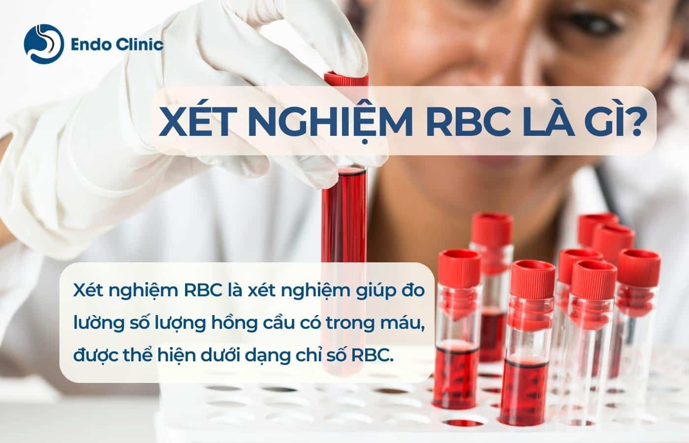 Xét nghiệm RBC trong máu là gì?