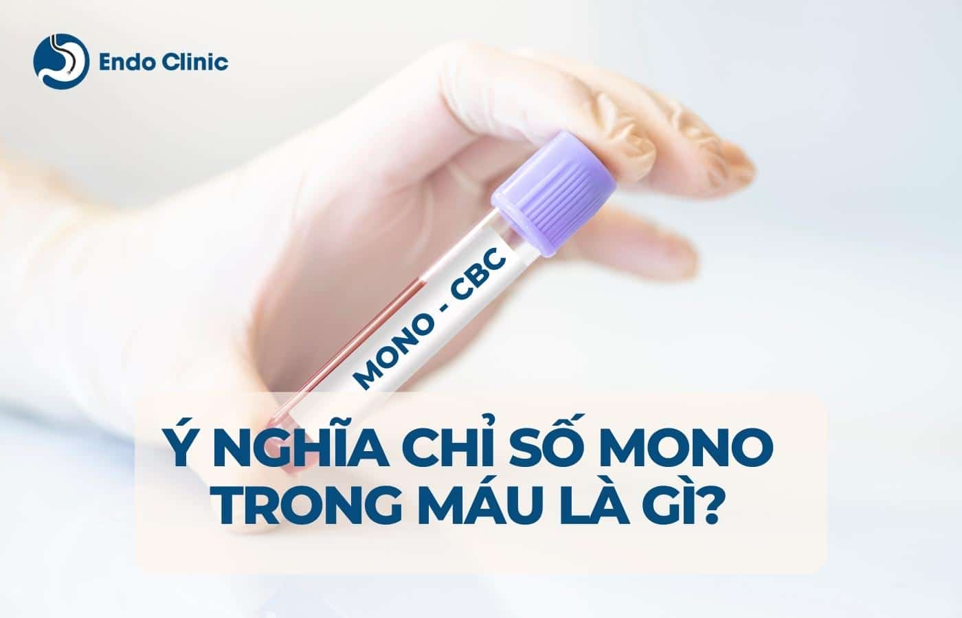 Ý nghĩa của chỉ số MONO trong máu là gì?
